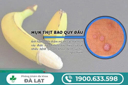 Hình ảnh minh họa